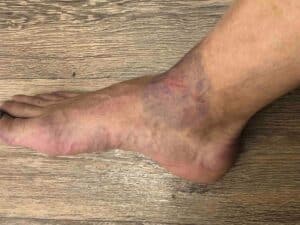 Гледайте внимателно — мястото е кв. Рилци‑Добрич, часът е „време за дузпа“, но според главния съдия Димитър Гебешев нарушение няма. Чувате ли този звук? Ударът в крака на нашия футболист беше толкова чист и силен, че ехото му се разнесе чак до центъра на Добрич. Явно в съвременния футбол критерият за дузпа е променен. Господин рефер, какво трябваше да се случи — да се счупи крак, за да отсъдите дузпа? Или трябваше да видим кръв на терена, за да признаете очевидното? Бенковски (Исперих) НЕ иска подаръци. Искаме просто честна игра. Но вчера в Рилци футболът остана на заден план заради едно съдийско „късогледство“. СРАМНО Е!!!